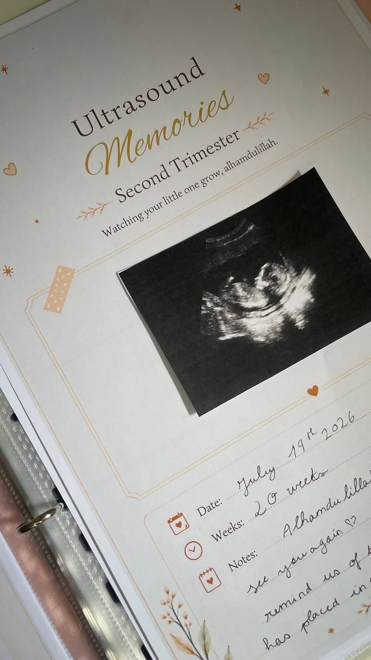 Pregnancy planner page with an ultrasound photo and handwritten pregnancy milestone notes.