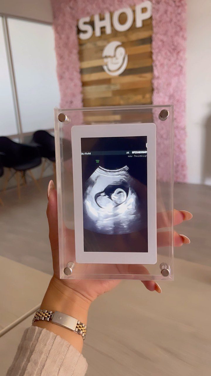 Sonogram image of a fetus held in a clear acrylic frame by a hand.